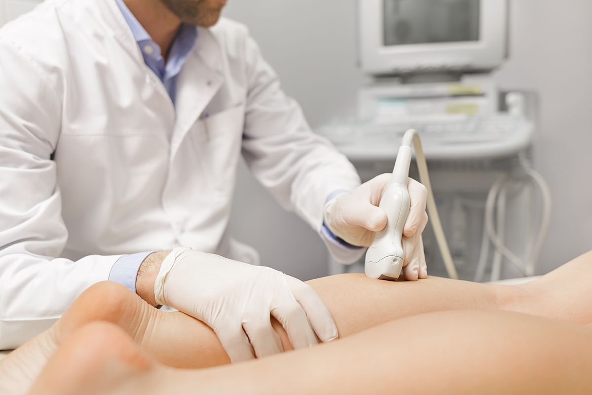 Beyond Aesthetics: Medical Benefits of Vein Removal Treatments