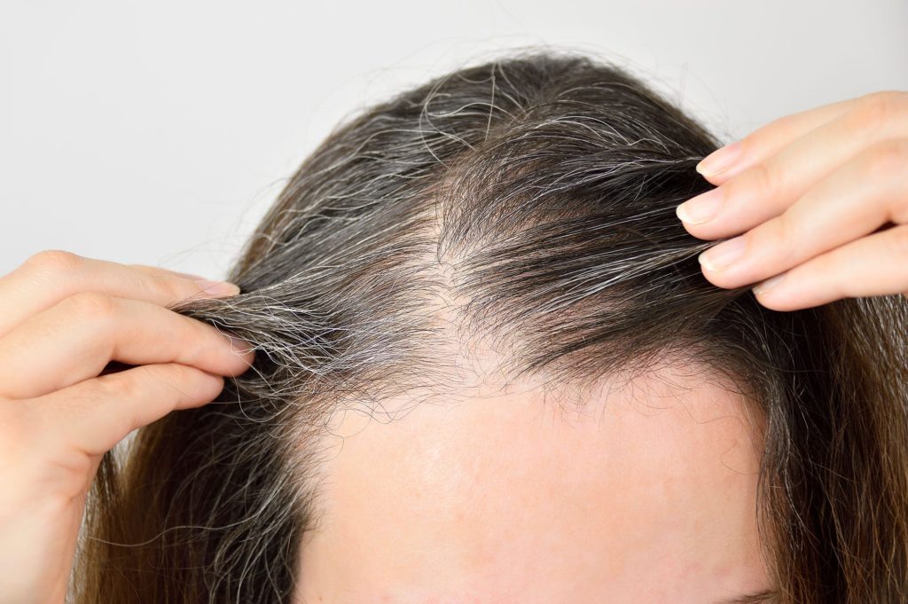 hair restoration