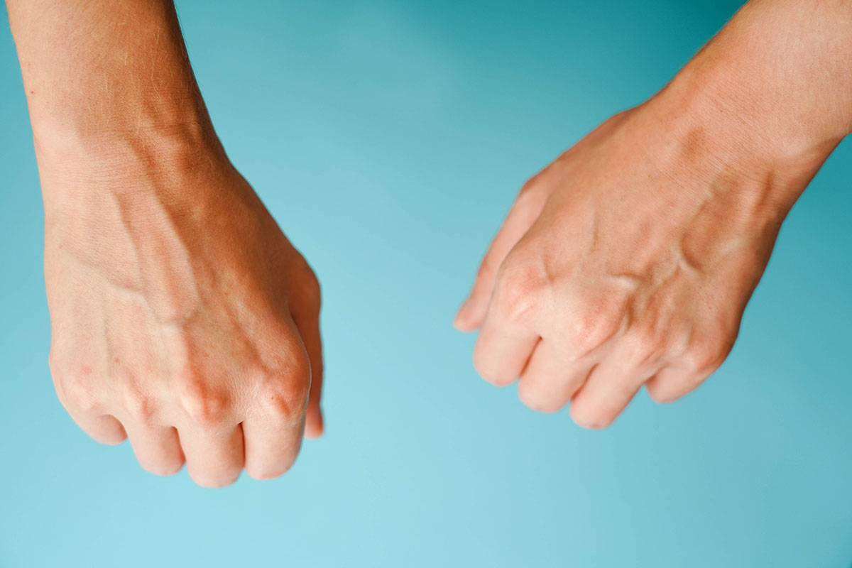 visible hand veins